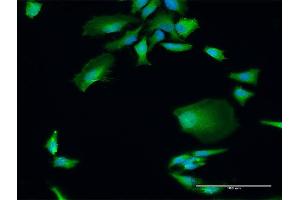 Immunofluorescence of purified MaxPab antibody to DGCR8 on HeLa cell. (DGCR8 Antikörper  (AA 1-773))