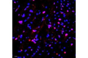 Immunofluorescence of paraffin embedded mouse heart using PRPF3 (ABIN7075311) at dilution of 1: 2200 (400x lens) (PRPF3 Antikörper)