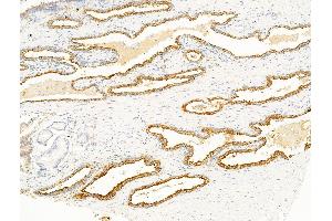 ABIN7094817 and ABIN7098868 at 1/100 staining Mouse heart tissue by IHC-P. (AGO4 Antikörper  (N-Term))