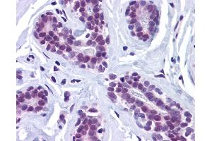 Anti-RBBP8 / CTIP antibody IHC of human breast. (Retinoblastoma Binding Protein 8 Antikörper  (Internal Region))