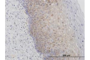 Immunoperoxidase of purified MaxPab antibody to RPL29 on formalin-fixed paraffin-embeddedhuman uterine cervix. (RPL29 Antikörper  (AA 1-159))