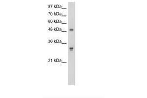 Image no. 1 for anti-DEAD (Asp-Glu-Ala-As) Box Polypeptide 19B (DDX19B) (AA 382-431) antibody (ABIN203175) (DDX19B Antikörper  (AA 382-431))