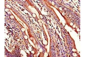 Immunohistochemistry (IHC) image for anti-Wingless-Type MMTV Integration Site Family, Member 1 (WNT1) (AA 142-288) antibody (ABIN7166507)