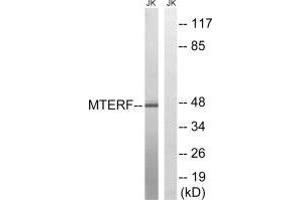 Western blot analysis of extracts from Jurkat cells, using MTERF antibody. (MTERF Antikörper)