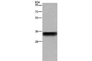 Western Blot analysis of Human placenta tissue using CD32 Polyclonal Antibody at dilution of 1:850 (Fc gamma RII (CD32) Antikörper)