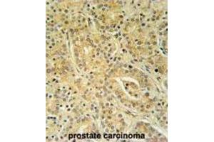 Immunohistochemistry (IHC) image for anti-UBA Domain Containing 1 (UBAC1) antibody (ABIN3002317) (UBAC1 Antikörper)