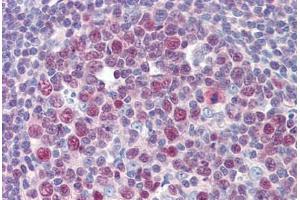 Immunohistochemistry (Paraffin-embedded Sections) (IHC (p)) image for anti-Transforming Growth Factor beta 1 Induced Transcript 1 (TGFB1I1) (N-Term) antibody (ABIN6741575)