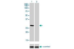 Western blot analysis of DLX4 over-expressed 293 cell line, cotransfected with DLX4 Validated Chimera RNAi (Lane 2) or non-transfected control (Lane 1).