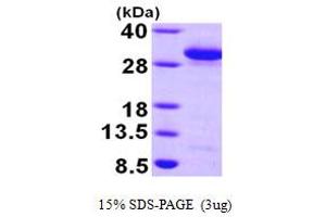 SDS-PAGE (SDS) image for RAB27A, Member RAS Oncogene Family (RAB27A) (AA 1-221) protein (His tag) (ABIN666995) (RAB27A Protein (AA 1-221) (His tag))