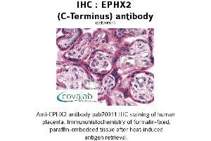 Image no. 2 for anti-Epoxide Hydrolase 2, Cytoplasmic (EPHX2) (C-Term) antibody (ABIN1734088) (EPHX2 Antikörper  (C-Term))
