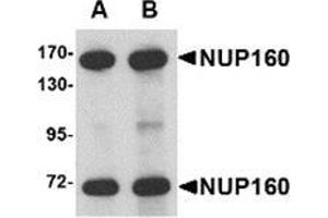 Western blot analysis of NUP160 in rat brain tissue lysate with NUP160 antibody at (A) 0. (NUP160 Antikörper  (C-Term))