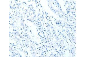 Immunohistochemistry (IHC) image for anti-Cadherin 23 (CDH23) antibody (ABIN1871707) (CDH23 Antikörper)