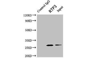 Immunoprecipitating RTP3 in Mouse brain tissue Lane 1: Rabbit control IgG (1 μg) instead of ABIN7167488 in Mouse brain tissue.