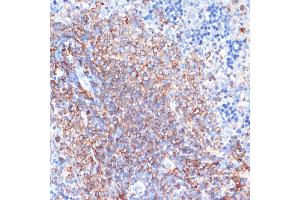 Immunohistochemistry of paraffin-embedded rat spleen using HLA-DRA antibody (ABIN6131757, ABIN6141827, ABIN6141829 and ABIN6215475) at dilution of 1:100 (40x lens).