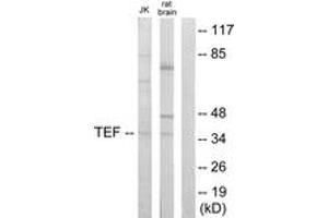Western blot analysis of extracts from Jurkat/rat brain cells, using TEF Antibody.