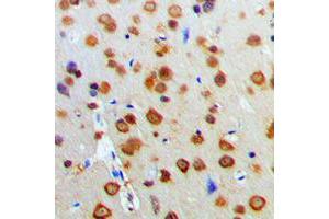 Immunohistochemical analysis of AKT staining in human brain formalin fixed paraffin embedded tissue section.