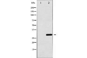 Western blot analysis of C/EBP-alpha expression in 293 whole cell lysates,The lane on the left is treated with the antigen-specific peptide. (CEBPA Antikörper  (N-Term))