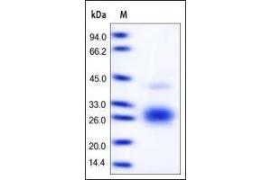 Human Fas Ligand, His Tag on SDS-PAGE under reducing (R) condition. (FASL Protein (AA 134-281) (His tag))