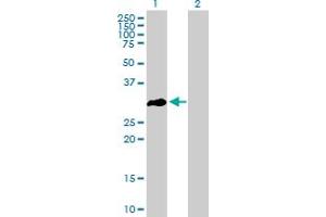 OLIG3 Antikörper  (AA 1-272)