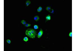 Immunofluorescent analysis of A431 cells using ABIN7151164 at dilution of 1:100 and Alexa Fluor 488-congugated AffiniPure Goat Anti-Rabbit IgG(H+L) (RNF182 Antikörper  (AA 1-160))