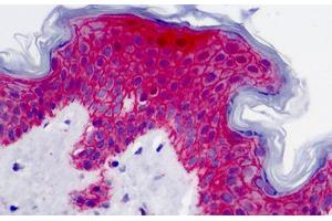 Human Skin: Formalin-Fixed, Paraffin-Embedded (FFPE) (Syndecan 1 Antikörper)