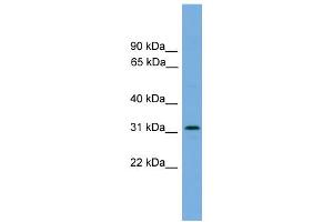 WB Suggested Anti-DAPP1 Antibody Titration: 0. (DAPP1 Antikörper  (Middle Region))