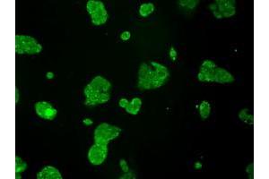 Anti-TTLL12 mouse monoclonal antibody (ABIN2453749) immunofluorescent staining of COS7 cells transiently transfected by pCMV6-ENTRY TTLL12 (RC200841). (TTLL12 Antikörper)
