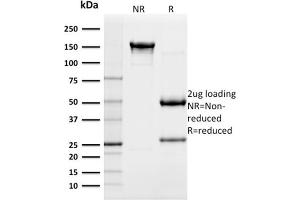 SDS-PAGE Analysis Purified CD117 Mouse Monoclonal Antibody (KIT/982). (KIT Antikörper  (AA 100-300))