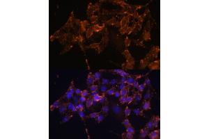 Immunofluorescence analysis of HeLa cells using COX1/COX1/PTGS1 Polyclonal Antibody (ABIN6130124, ABIN6146413, ABIN6146414 and ABIN6223187) at dilution of 1:100 (40x lens). (PTGS1 Antikörper  (AA 1-180))