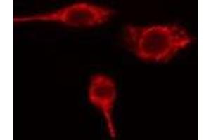 Immunofluorescence (fixed cells) (IF/ICC) image for anti-Vesicle Transport through Interaction with T-SNAREs Homolog 1B (VTI1B) (Internal Region) antibody (ABIN6259233)