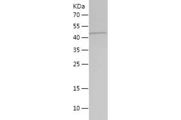 ARPC1B Protein (AA 175-372) (His-IF2DI Tag)