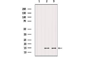 Western blot analysis of extracts from various samples, using SERF2 Antibody.