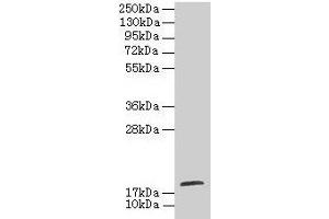 Western blot All lanes: TPPP2 antibody at 8 μg/mL + HepG2 whole cell lysate Secondary Goat polyclonal to rabbit IgG at 1/10000 dilution Predicted band size: 19 kDa Observed band size: 19 kDa (TPPP2 Antikörper  (AA 1-170))