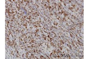 Image no. 2 for anti-RAB27A, Member RAS Oncogene Family (RAB27A) (AA 122-222) antibody (ABIN598569) (RAB27A Antikörper  (AA 122-222))