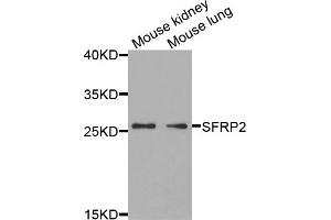 Western blot analysis of extracts of various cell lines, using SFRP2 antibody (ABIN5973117) at 1/1000 dilution. (SFRP2 Antikörper)