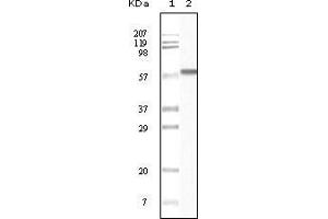Western blot analysis using CK1 mouse mAb against truncated CK1 recombinant protein.