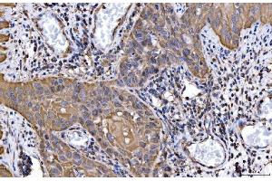 IHC analysis of HGS using anti-HGS antibody (ABIN7601206). (HGS Antikörper  (AA 3-777))