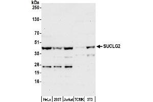anti-Succinate-CoA Ligase, GDP-Forming, beta Subunit (SUCLG2) (AA 25-75) antibody