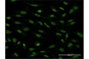 Immunofluorescence of monoclonal antibody to OXSR1 on HeLa cell. (OXSR1 Antikörper  (AA 351-450))