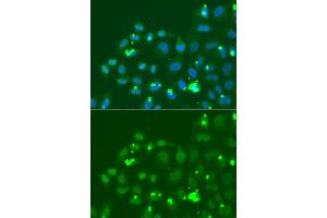 Immunofluorescence analysis of A549 cell using ATF3 antibody. (ATF3 Antikörper)