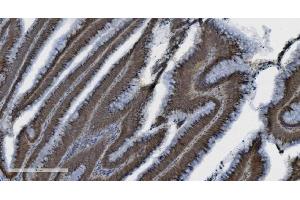 IHC analysis of PARP using anti-PARP antibody (ABIN7602277). (PARP1 Antikörper  (AA 670-858))