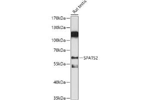 Western blot analysis of extracts of Rat testis, using SP antibody (ABIN7270526) at 1:1000 dilution. (SPATS2 Antikörper  (AA 1-240))
