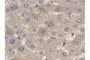 Detection of ME2 in Human Liver Tissue using Polyclonal Antibody to Malic Enzyme 2, NADP+ Dependent, Mitochondrial (ME2) (Malic Enzyme 2, NADP+ Dependent, Mitochondrial (AA 220-426) Antikörper)