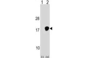 Western Blotting (WB) image for anti-Ubiquitin-Conjugating Enzyme E2D 3 (UBE2D3) antibody (ABIN2999003) (UBE2D3 Antikörper)