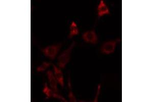 ABIN6275765 staining NIH-3T3 by IF/ICC. (FGFRL1 Antikörper  (Internal Region))