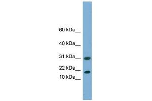 WB Suggested Anti-EIF5A2 Antibody Titration: 0. (EIF5A2 Antikörper  (N-Term))