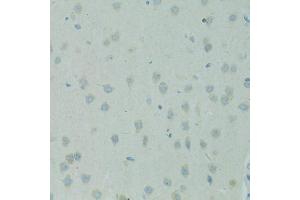Immunohistochemistry of paraffin-embedded rat brain using SMAD6 antibody. (SMAD6 Antikörper)