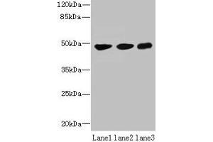 Western blot All lanes: UXS1 antibody at 6 μg/mL Lane 1: Mouse lung tissue Lane 2: Jurkat whole cell lysate Lane 3: HepG2 whole cell lysate Secondary Goat polyclonal to rabbit IgG at 1/10000 dilution Predicted band size: 48, 49, 29 kDa Observed band size: 48 kDa (UXS1 Antikörper  (AA 201-420))