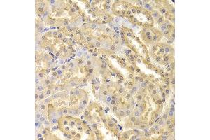 Immunohistochemistry of paraffin-embedded Mouse kidney using CDK9 antibody at dilution of 1:100 (x400 lens). (CDK9 Antikörper  (AA 153-372))