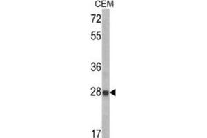 Western Blotting (WB) image for anti-Insulin-Like Growth Factor Binding Protein 6 (IGFBP6) antibody (ABIN3002791) (IGFBP6 Antikörper)